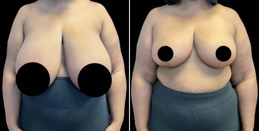 Plastic Surgery Results