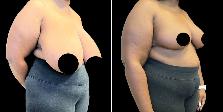 Plastic Surgery Results
