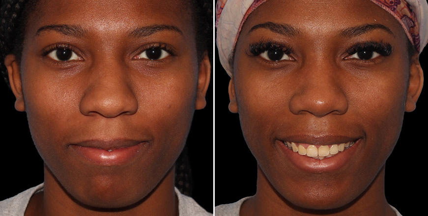 Plastic Surgery Results