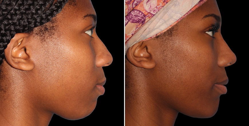 Plastic Surgery Results