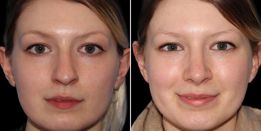 Plastic Surgery Results