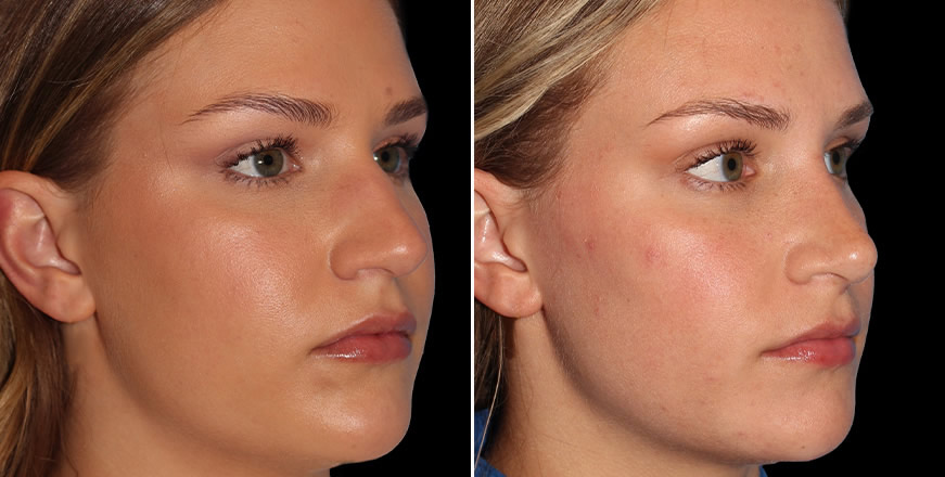 Plastic Surgery Results