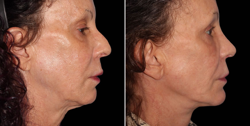 Plastic Surgery Results